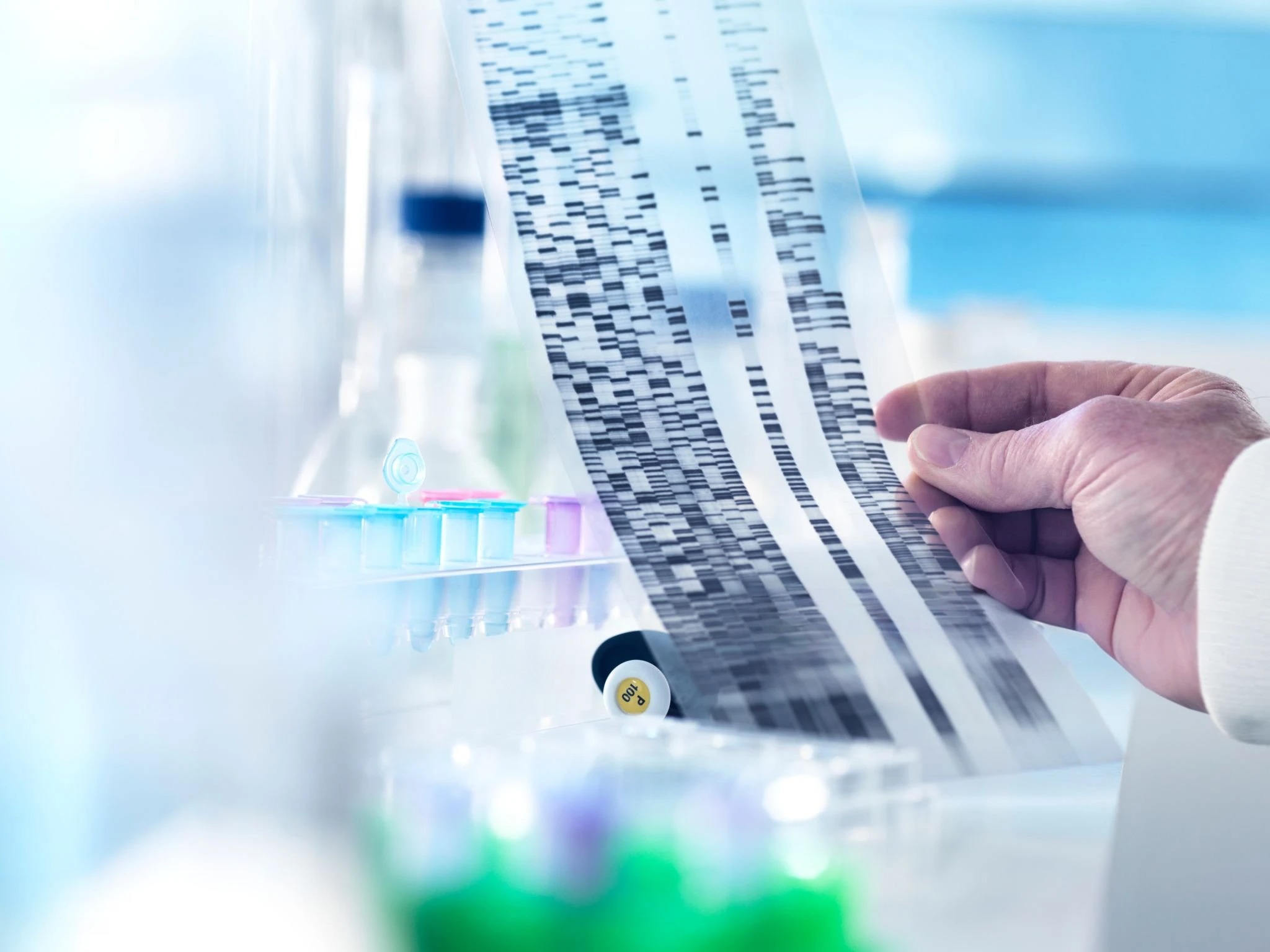 A scientist examines a DNA sequencing gel in a laboratory, focused on genetic analysis and research activities.